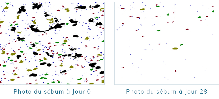 Avant après soin serum équilibrant